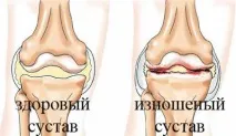 болять