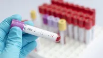 Останні розробкиу лікуванні ВІЛ розробкиу
