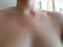 гръдната кост