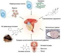 причини причини