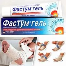 Розтягнення м’язів розтягнення