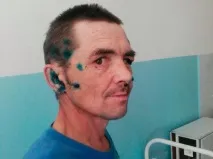 український грибник, котрий голими руками відбився від ведмедя, став героєм західних ЗМІ грибник