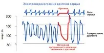 синусова време