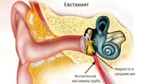евстахиит евстахиит