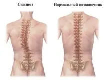 възрастни костната тъкан