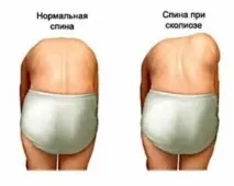 възрастни гръбначния стълб