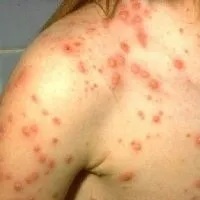 възрастни първи