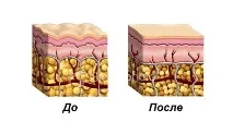 celluless масажор