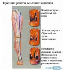 краката конгестия