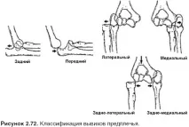 симптоми симптоми