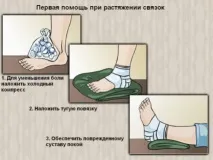 изкълчено дома