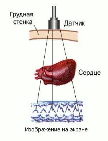 Звукові явища в серці, Енциклопедія явища