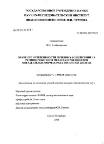 интензивността върху