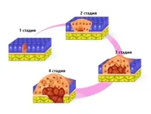 шкіри