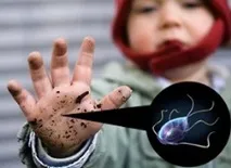 babyklad тест