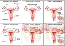 лечения долната част