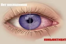 причини бактериален