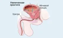 лекува медикаментозно