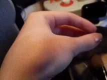 цялото лице какавида