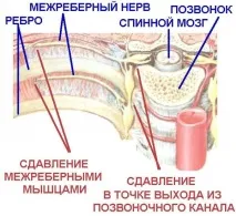 Болить у серці при вагітності, причини, що робити причини