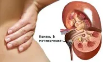 какво правите