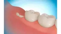 мъдростта години