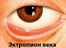 симптоми причини