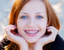 Фіксація ортодонтичної кнопки, студія Andreeva PearlSmile студія