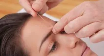 акупунктура акупунктура