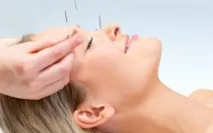 акупунктура активни точки