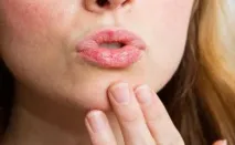 Як і чим лікувати рани в роті та на небі рани