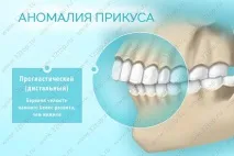 Виправлення прикусу без брекетів у дорослих та дітей види, причини та ознаки неправильного прикусу виправлення
