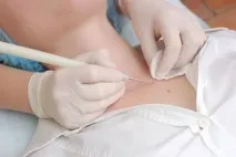 Як передається вірус папіломи людини шляхи зараження ВПЛ людини