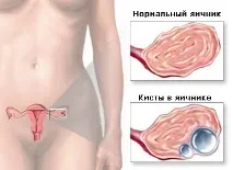 симптоми