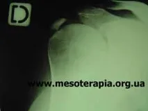 терапевтична терапевтична