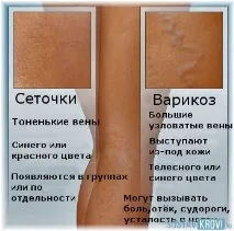 капиляри капиляри