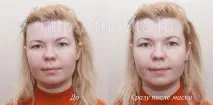 Косметичні маски Vision I MAgeQ косметичні