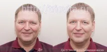 Косметичні маски Vision I MAgeQ mageq
