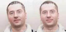 Косметичні маски Vision I MAgeQ косметичні