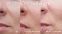 Косметичні маски Vision I MAgeQ косметичні