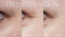 Косметичні маски Vision I MAgeQ косметичні