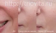 Косметичні маски Vision I MAgeQ косметичні