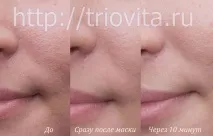 Косметичні маски Vision I MAgeQ косметичні