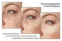 бразда корекция