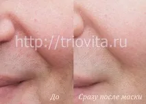 Косметичні маски Vision I MAgeQ mageq