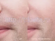 Косметичні маски Vision I MAgeQ mageq