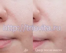 Косметичні маски Vision I MAgeQ Vision