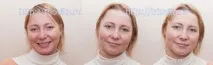 Косметичні маски Vision I MAgeQ mageq