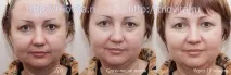 Косметичні маски Vision I MAgeQ Vision