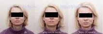 Косметичні маски Vision I MAgeQ косметичні